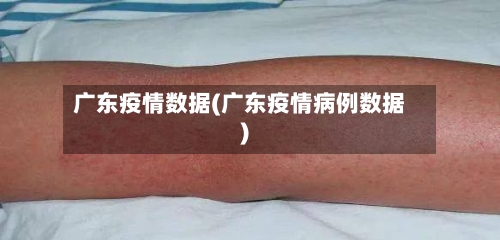 广东疫情数据(广东疫情病例数据)-第3张图片