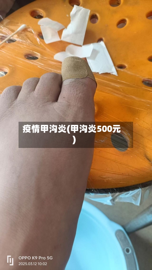 疫情甲沟炎(甲沟炎500元)-第1张图片