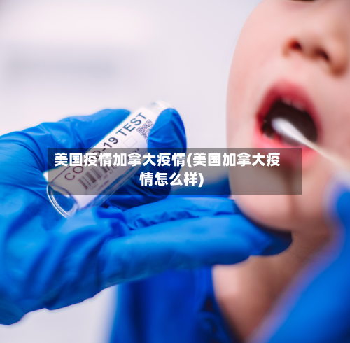 美国疫情加拿大疫情(美国加拿大疫情怎么样)-第1张图片